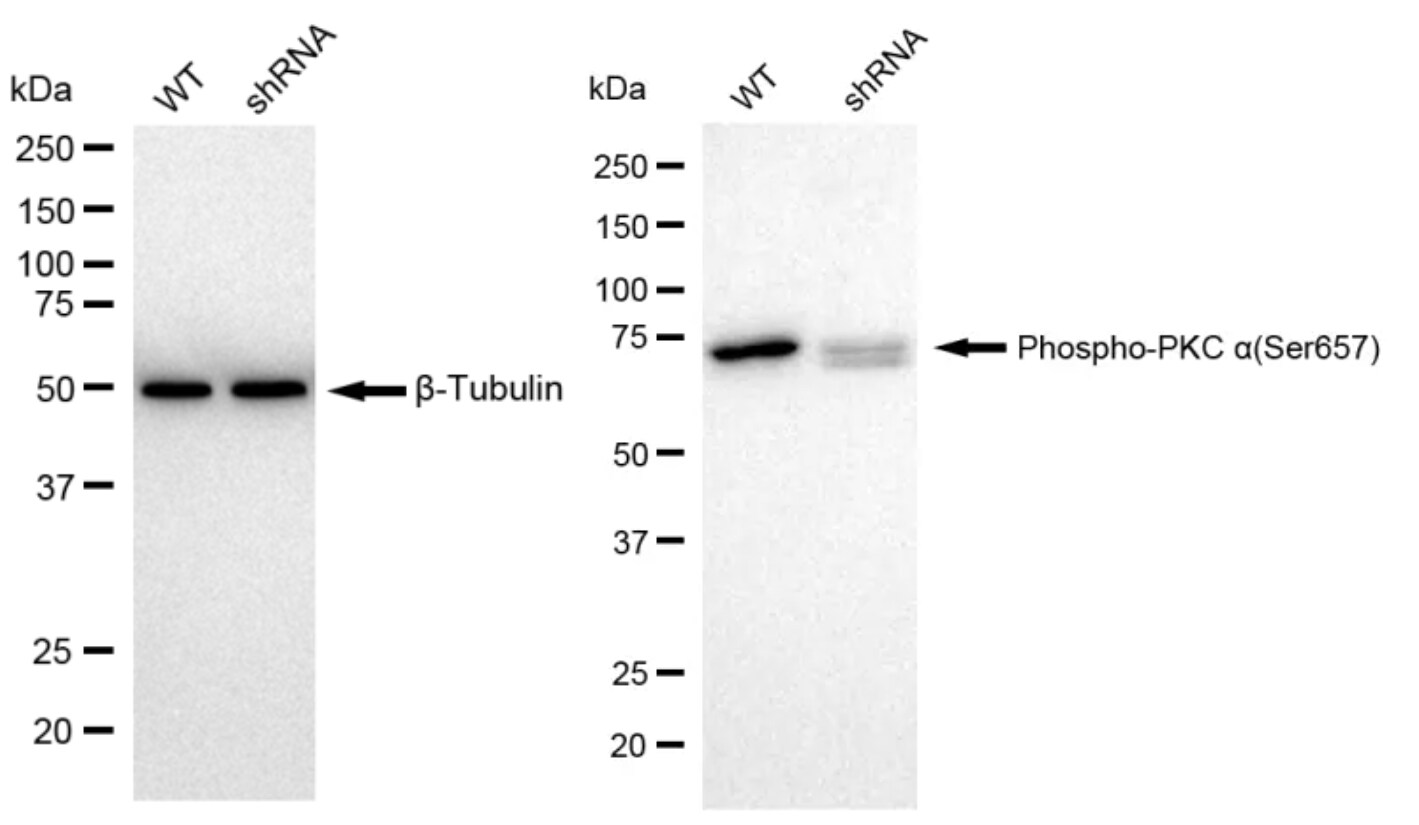 PKC alpha [p Ser657] Antibody (23GB1055)