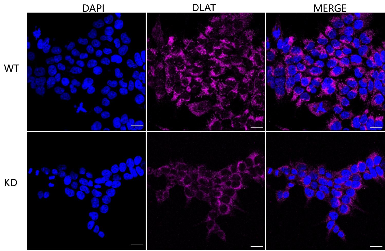 Pyruvate Dehydrogenase E2 Antibody (23GB805)
