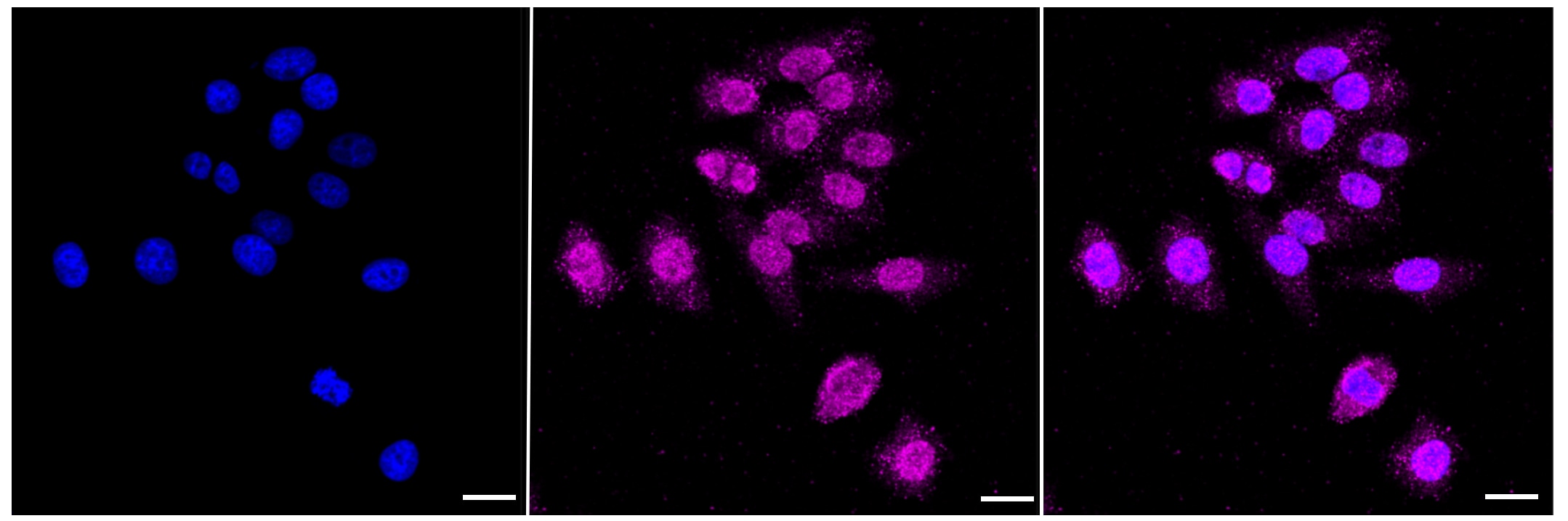 ABH1 Antibody (23GB1385)