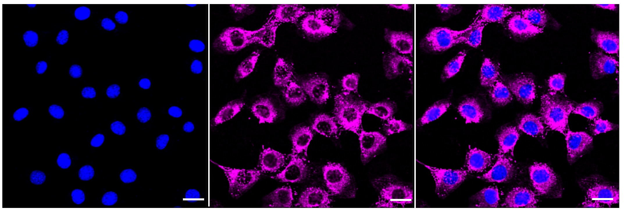 Fibronectin Antibody (23GB1270)