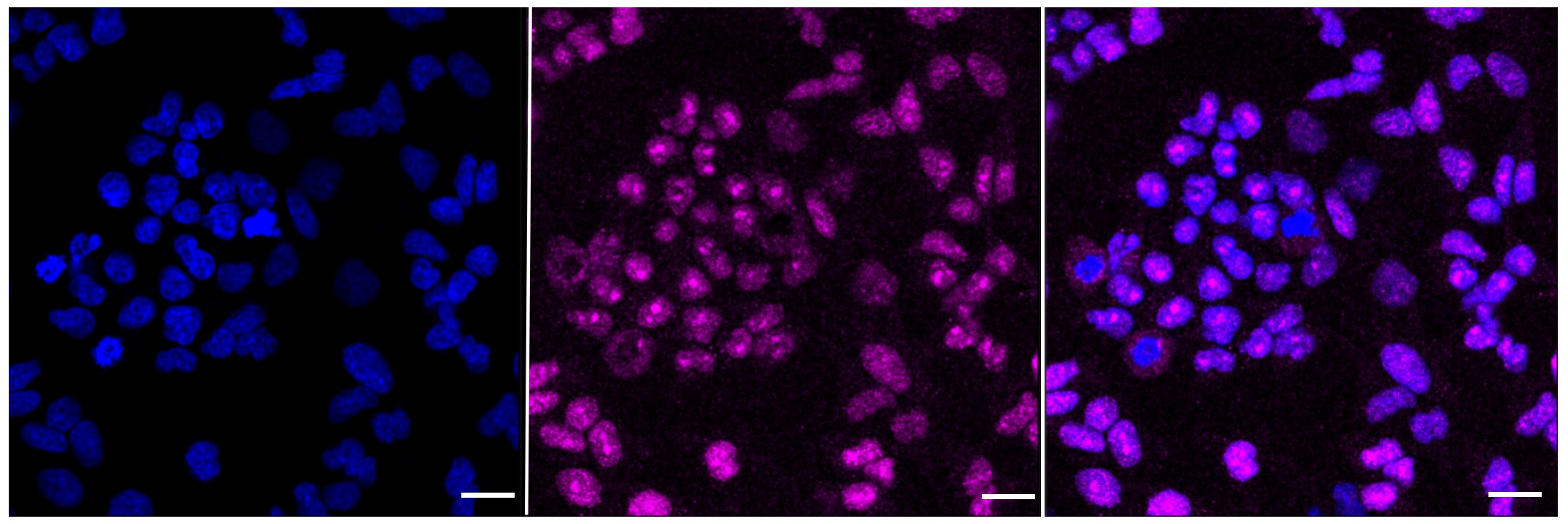 BMI-1 Antibody (23GB685)