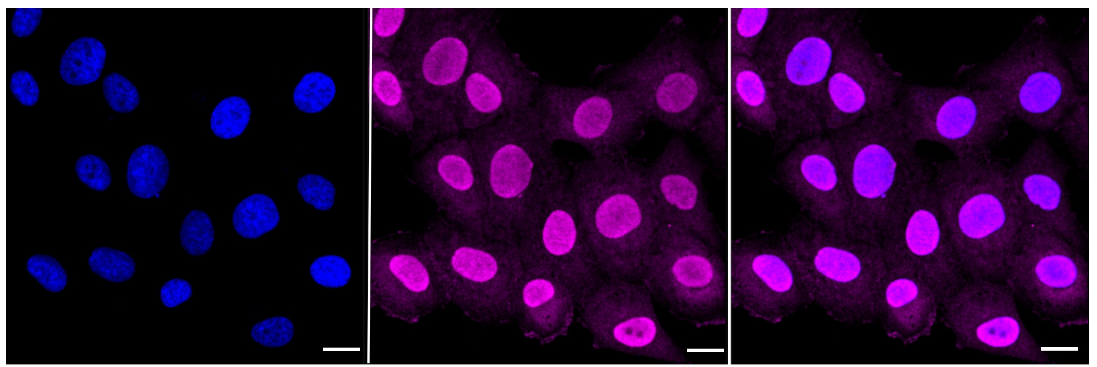 Annexin V Antibody (23GB650)