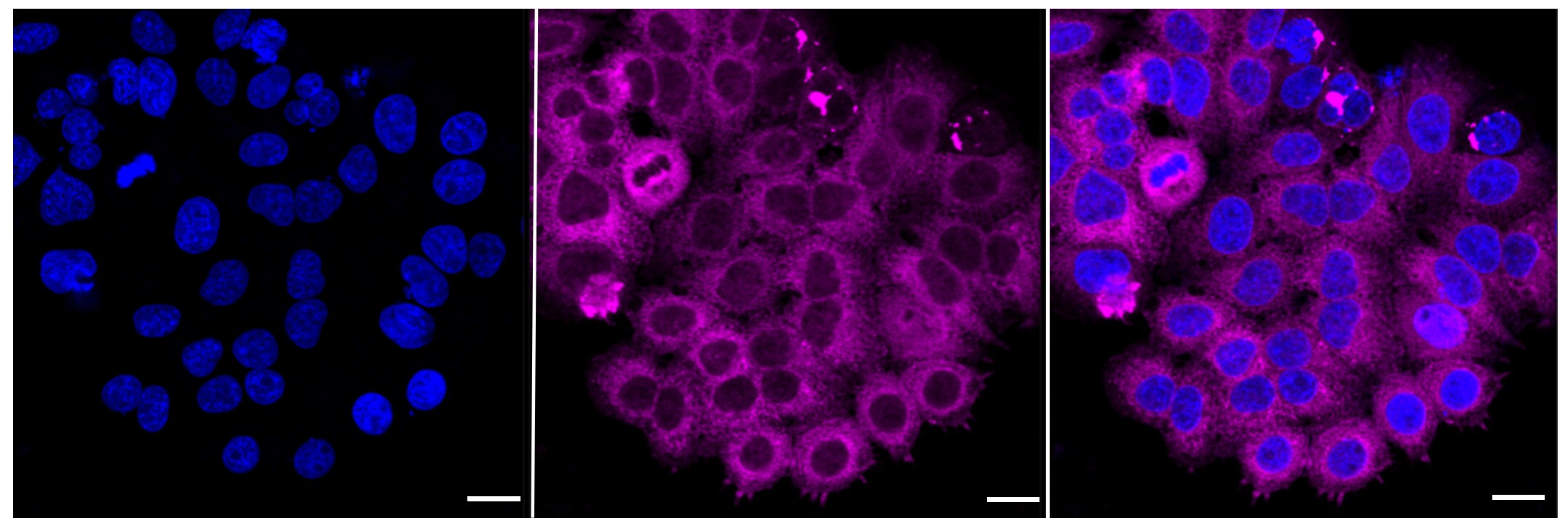RRM1 Antibody (23GB960)