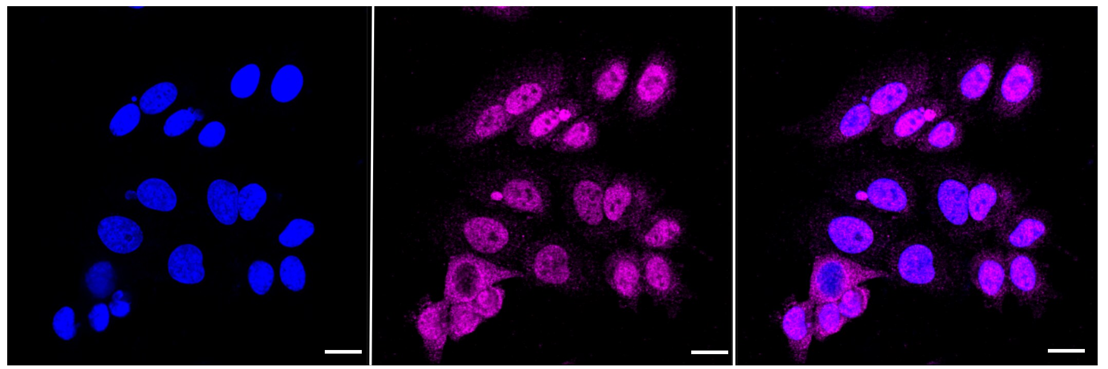 ARNT/HIF-1 beta Antibody (23GB660)