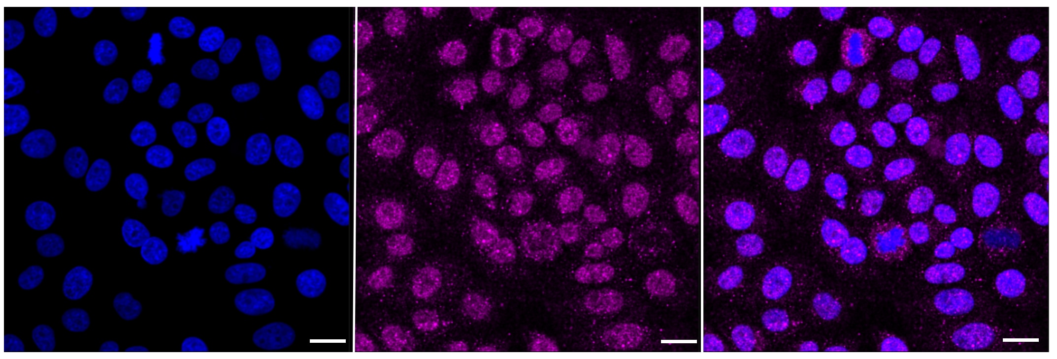 beta-Arrestin 1 Antibody (23GB1755)