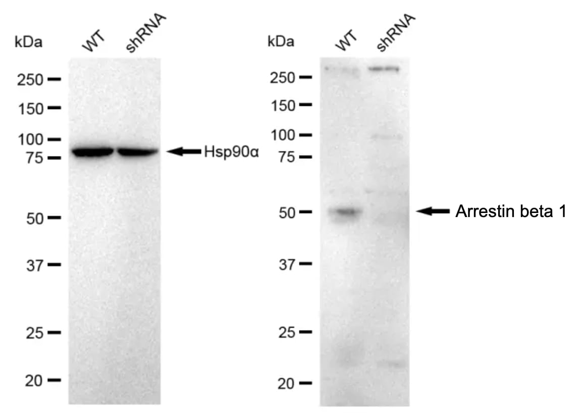 beta-Arrestin 1 Antibody (23GB1755)