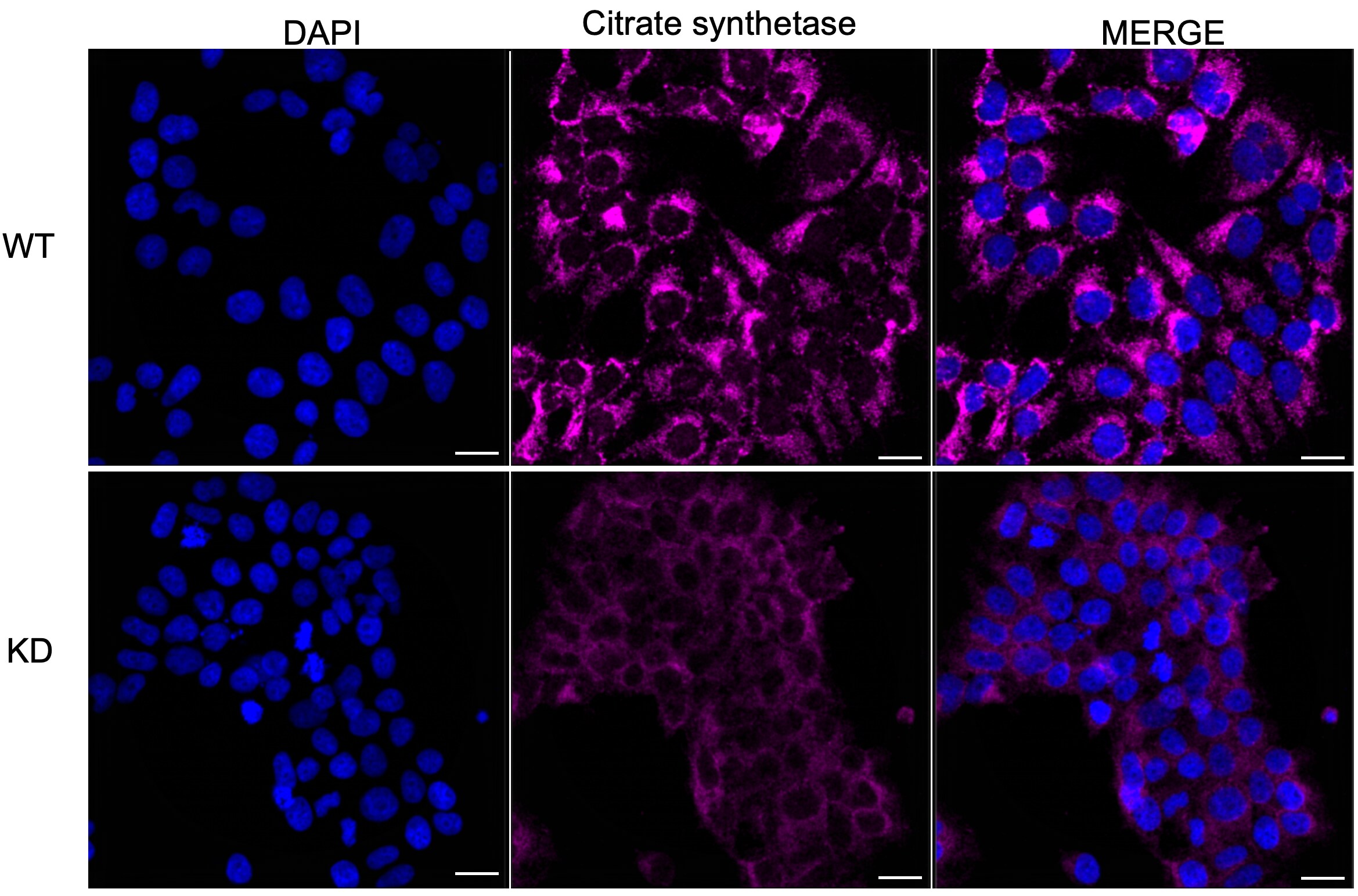 CS Citrate Synthase Antibody (23GB780)