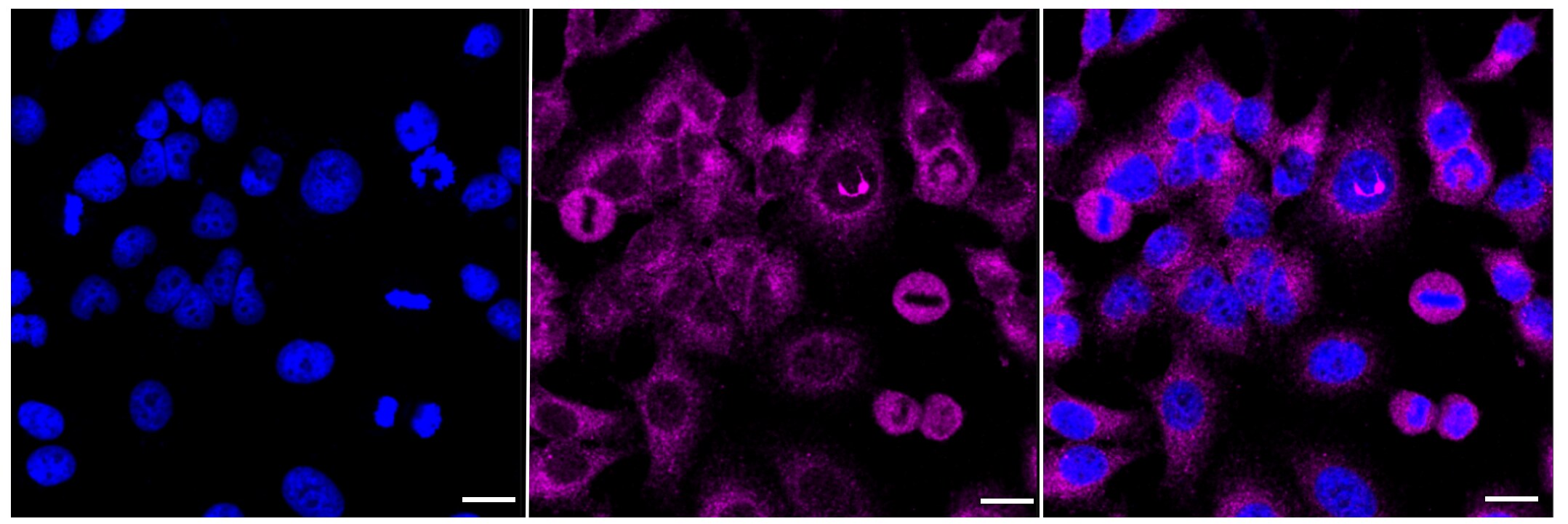TSC2 Antibody (23GB1000)