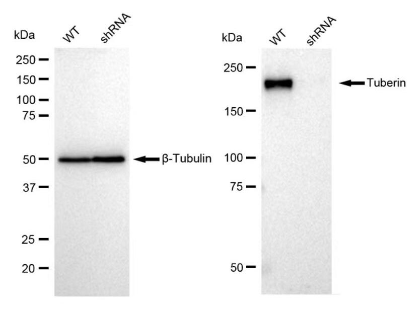 TSC2 Antibody (23GB1000)