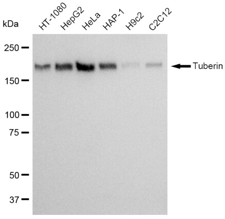 TSC2 Antibody (23GB1000)