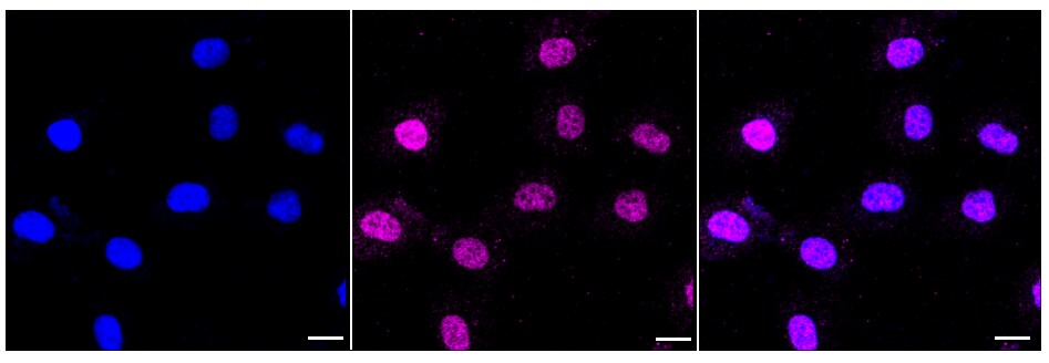 STAT6 Antibody (23GB4215)