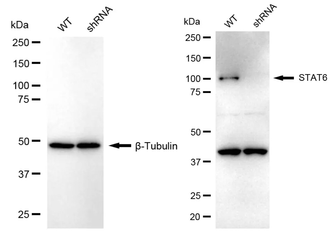 STAT6 Antibody (23GB4215)