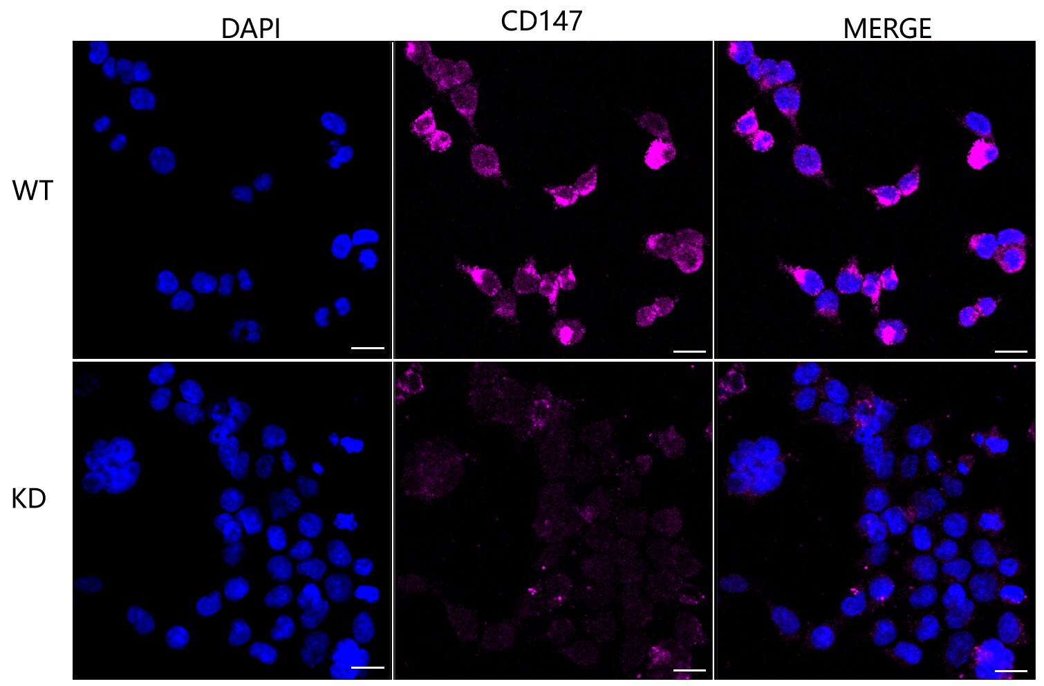 EMMPRIN/CD147 Antibody (23GB1460)