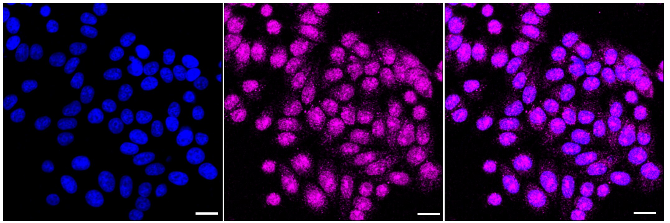 EMMPRIN/CD147 Antibody (23GB1460)