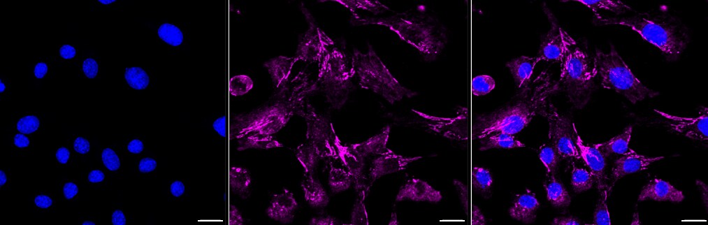 Integrin alpha 5/CD49e Antibody (23GB880)