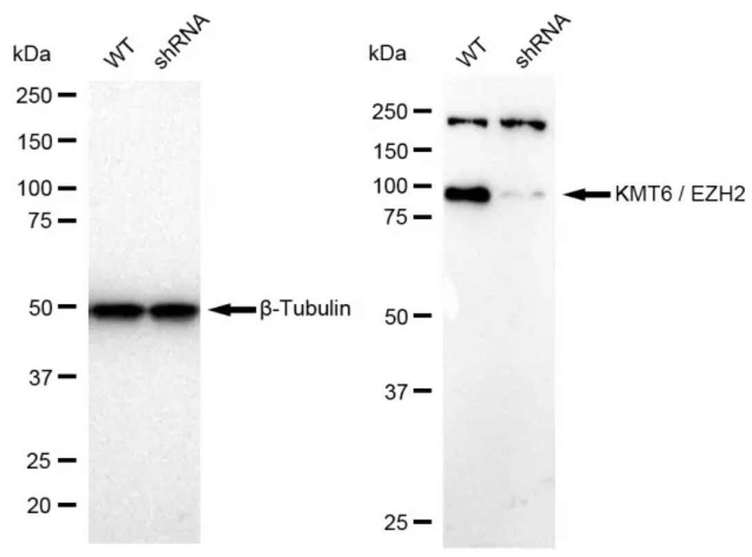 EZH2/KMT6 Antibody (23GB835)