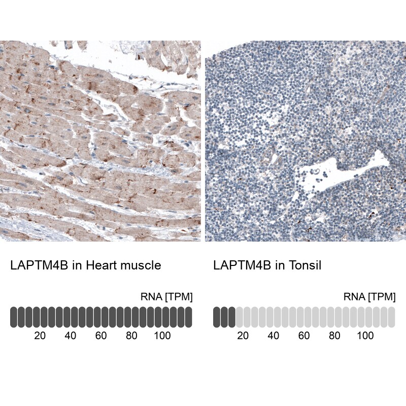 LAPTM4B Antibody (CL5289) Immunohistochemistry: LAPTM4B Antibody (CL5289) [NBP3-52478]
