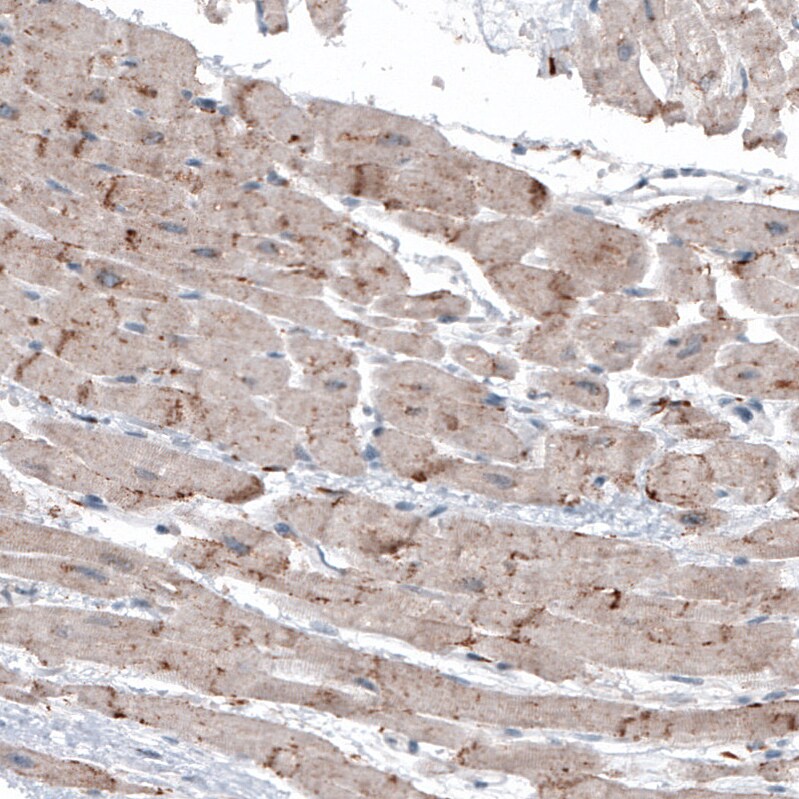 LAPTM4B Antibody (CL5289) Immunohistochemistry: LAPTM4B Antibody (CL5289) [NBP3-52478]
