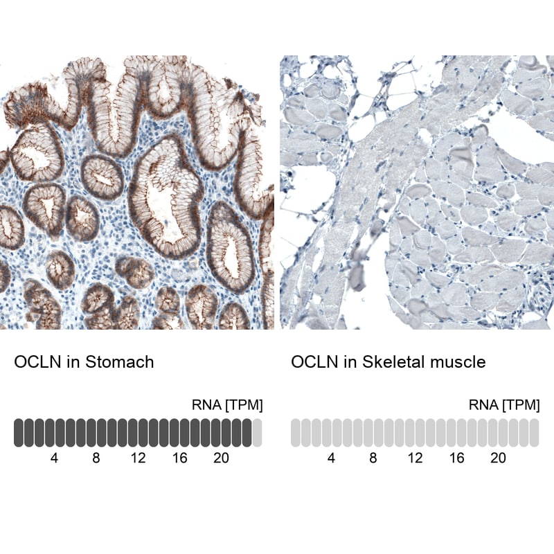 Occludin Antibody (CL1555) Immunohistochemistry: Occludin Antibody (CL1555) [NBP3-52455]