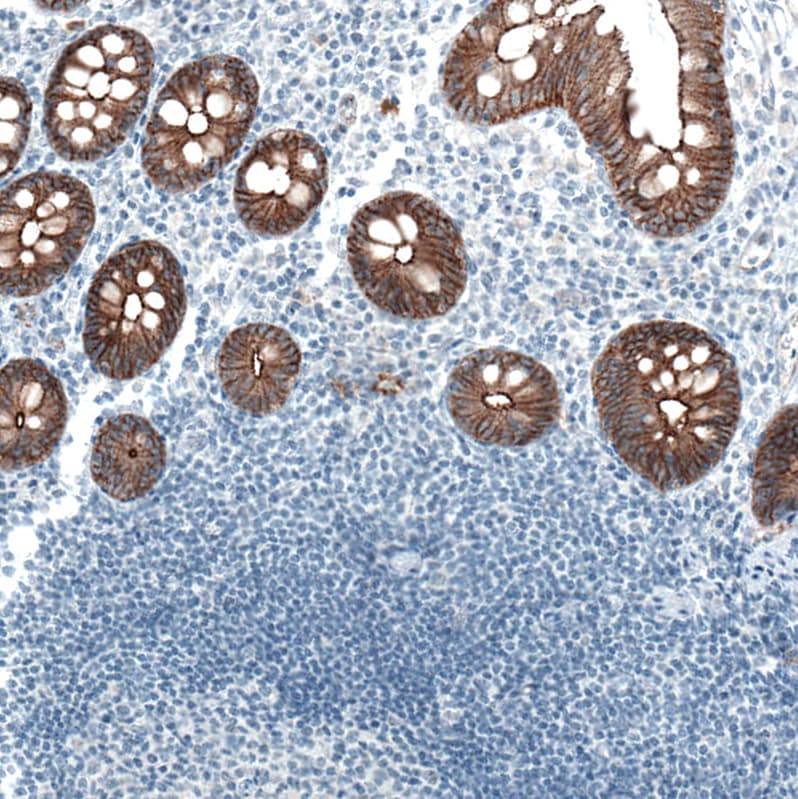 Occludin Antibody (CL1555) Immunohistochemistry: Occludin Antibody (CL1555) [NBP3-52455]