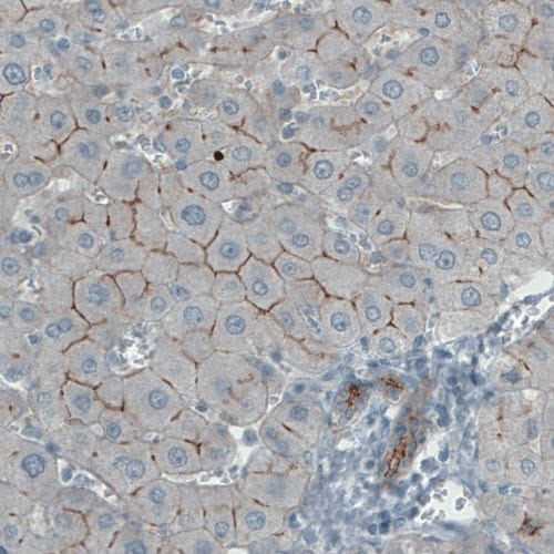 Occludin Antibody (CL1555) Immunohistochemistry: Occludin Antibody (CL1555) [NBP3-52455]