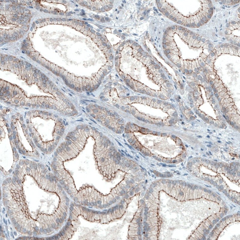 Occludin Antibody (CL1555) Immunohistochemistry: Occludin Antibody (CL1555) [NBP3-52455]