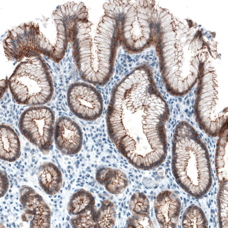 Occludin Antibody (CL1555) Immunohistochemistry: Occludin Antibody (CL1555) [NBP3-52455]