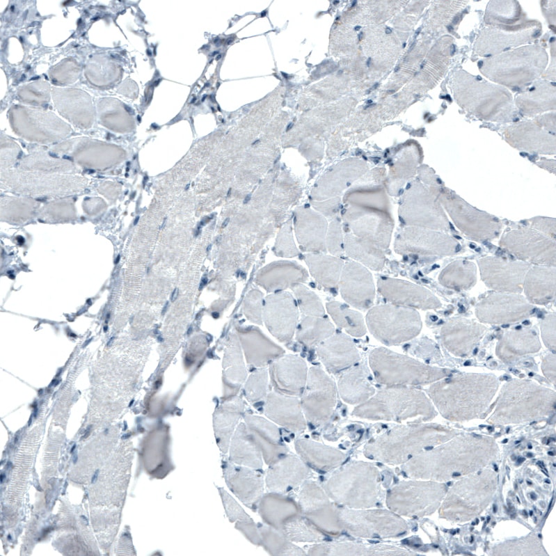 Occludin Antibody (CL1555) Immunohistochemistry: Occludin Antibody (CL1555) [NBP3-52455]