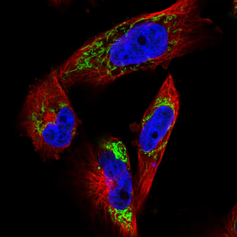 TUFM Antibody (CL2242) Immunocytochemistry/ Immunofluorescence: TUFM Antibody (CL2242) [NBP3-52456]