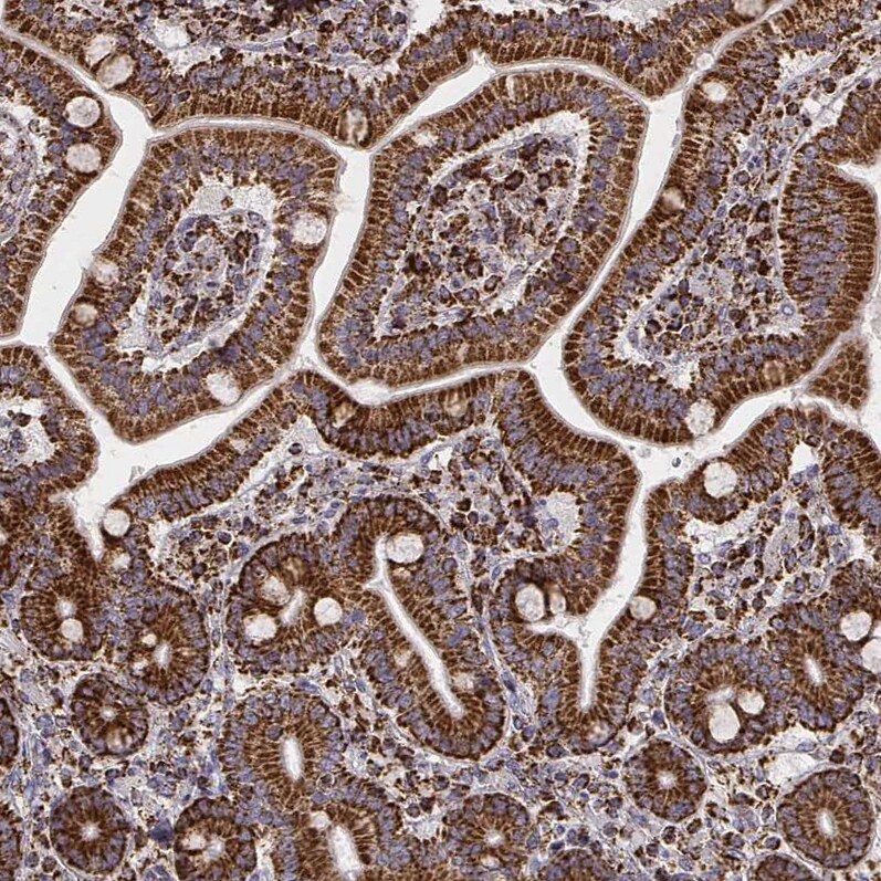 TUFM Antibody (CL2242) Immunohistochemistry: TUFM Antibody (CL2242) [NBP3-52456]
