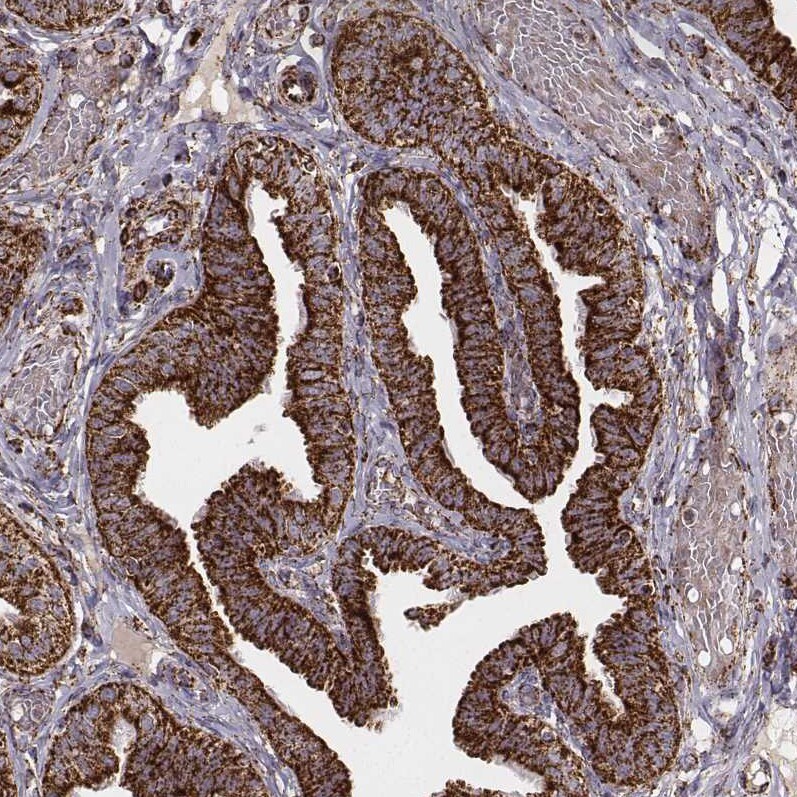 TUFM Antibody (CL2242) Immunohistochemistry: TUFM Antibody (CL2242) [NBP3-52456]