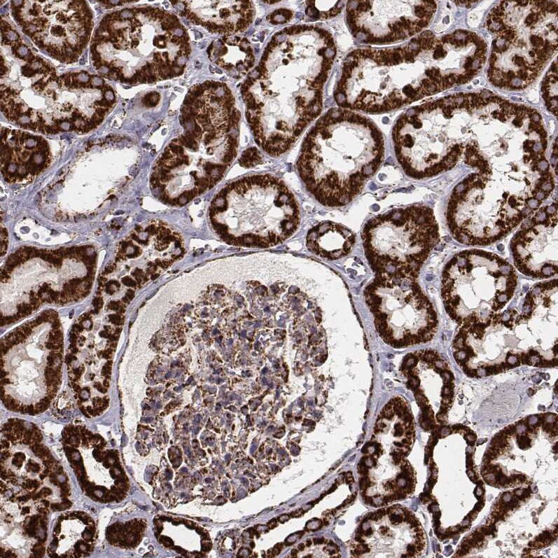 TUFM Antibody (CL2242) Immunohistochemistry: TUFM Antibody (CL2242) [NBP3-52456]