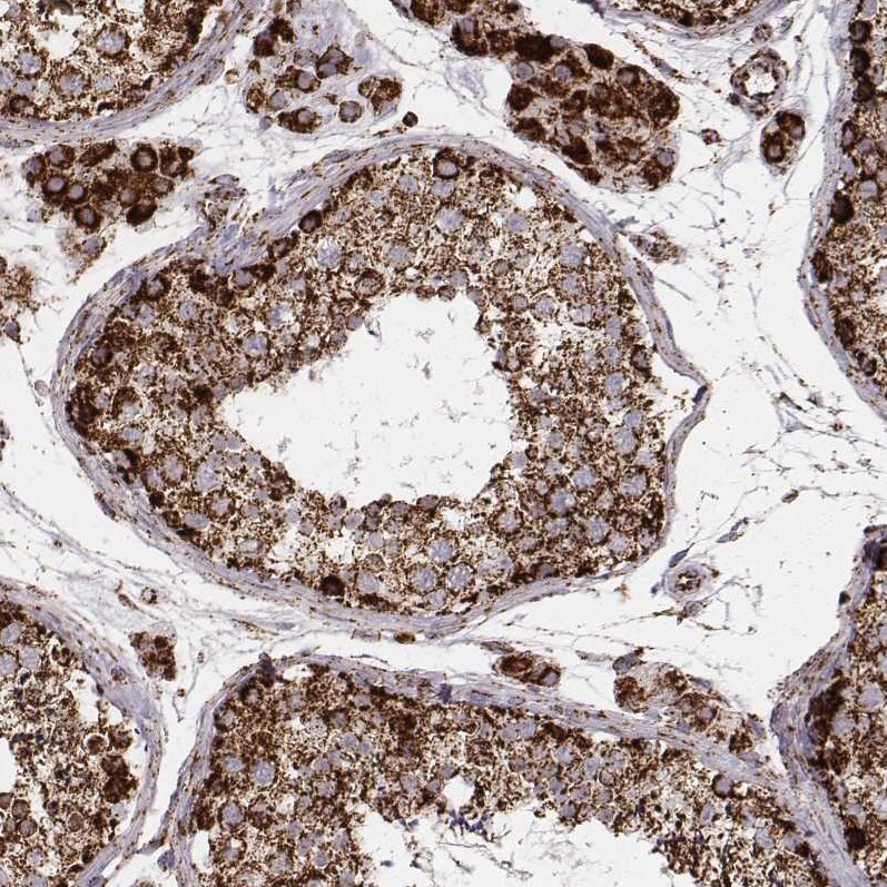 TUFM Antibody (CL2242) Immunohistochemistry: TUFM Antibody (CL2242) [NBP3-52456]