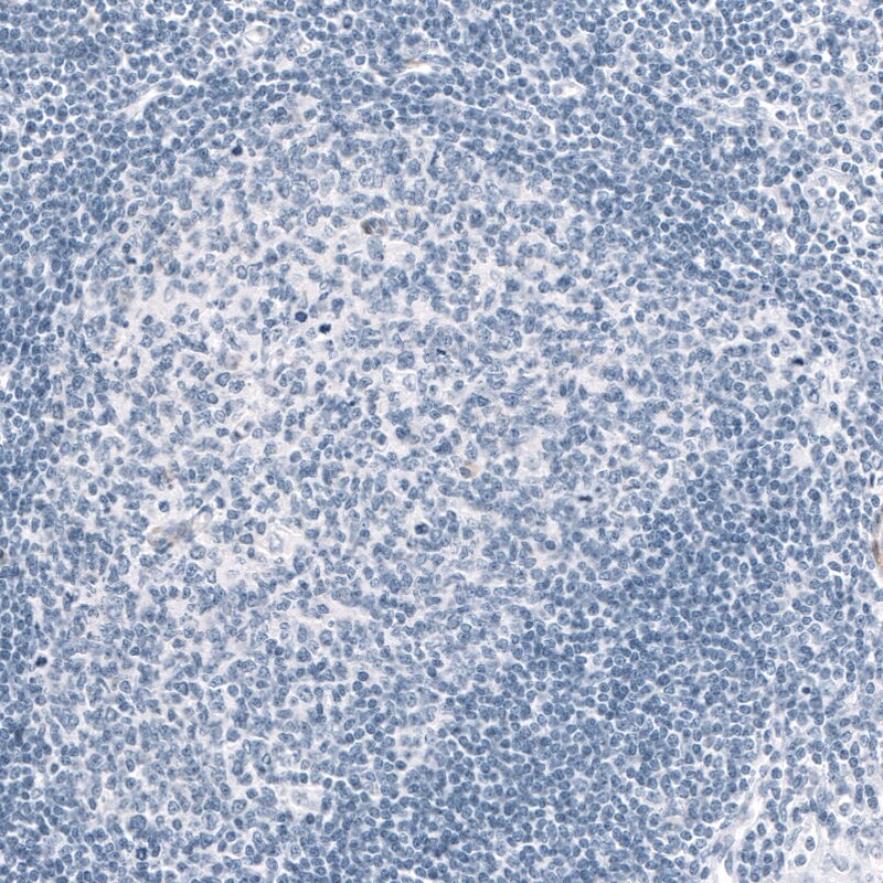 MAP2 Antibody (CL5420) Immunohistochemistry: MAP2 Antibody (CL5420) [NBP3-52490]