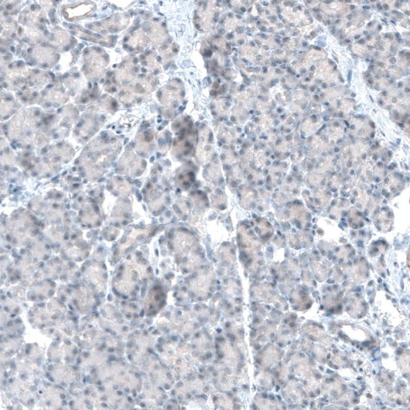 TET2 Antibody (CL6873) Immunohistochemistry: TET2 Antibody (CL6873) [NBP3-52484]