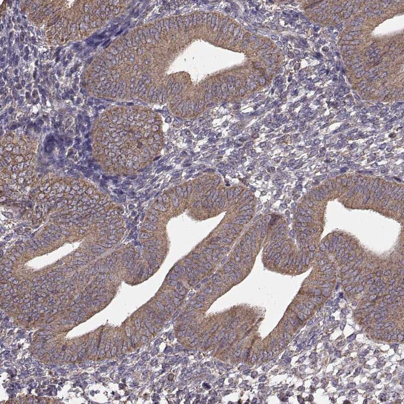 ERp57/PDIA3 Antibody (CL2444) Immunohistochemistry: ERp57/PDIA3 Antibody (CL2444) [NBP3-52458]