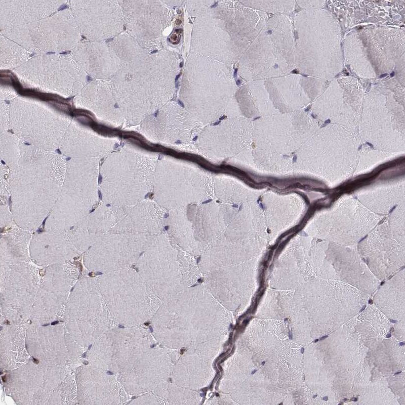 ERp57/PDIA3 Antibody (CL2444) Immunohistochemistry: ERp57/PDIA3 Antibody (CL2444) [NBP3-52458]