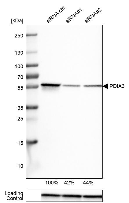 ERp57/PDIA3 Antibody (CL2444) Western Blot: ERp57/PDIA3 Antibody (CL2444) [NBP3-52458]