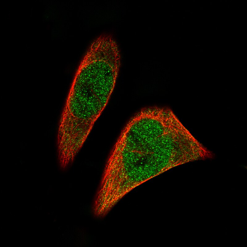 SOX11 Antibody (CL0142) Immunocytochemistry/ Immunofluorescence: SOX11 Antibody (CL0142) [NBP3-52441]