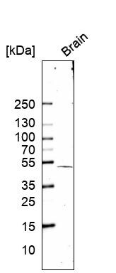 SOX11 Antibody (CL0142) Western Blot: SOX11 Antibody (CL0142) [NBP3-52441]
