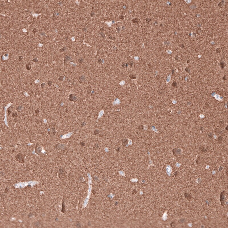 beta-III Tubulin Antibody (CL5813) Immunohistochemistry: beta-III Tubulin Antibody (CL5813) [NBP3-52481]