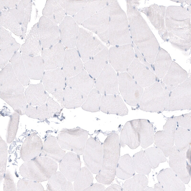 beta-III Tubulin Antibody (CL5813) Immunohistochemistry: beta-III Tubulin Antibody (CL5813) [NBP3-52481]