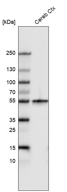 beta-III Tubulin Antibody (CL5813) Western Blot: beta-III Tubulin Antibody (CL5813) [NBP3-52481]