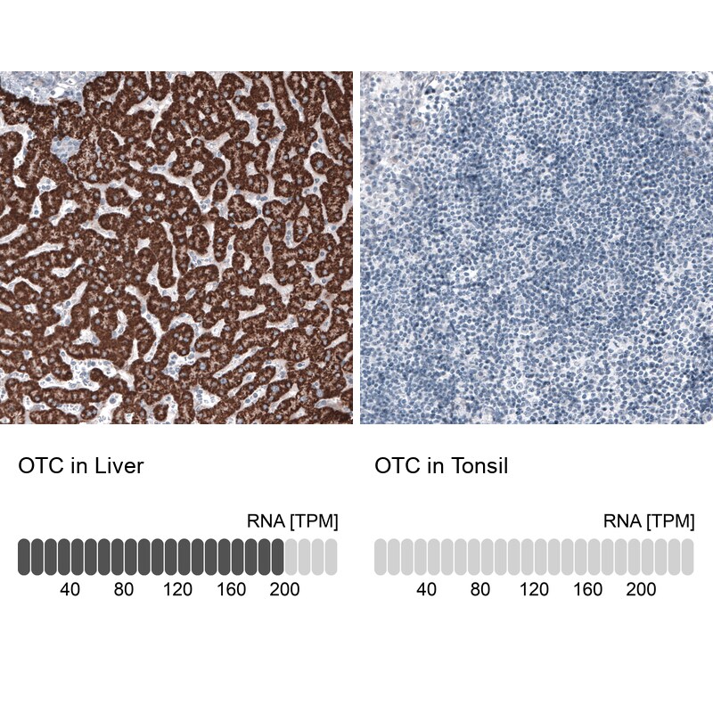 Ornithine Carbamoyltransferase Antibody (CL4045) Immunohistochemistry: Ornithine Carbamoyltransferase Antibody (CL4045) [NBP3-52475]