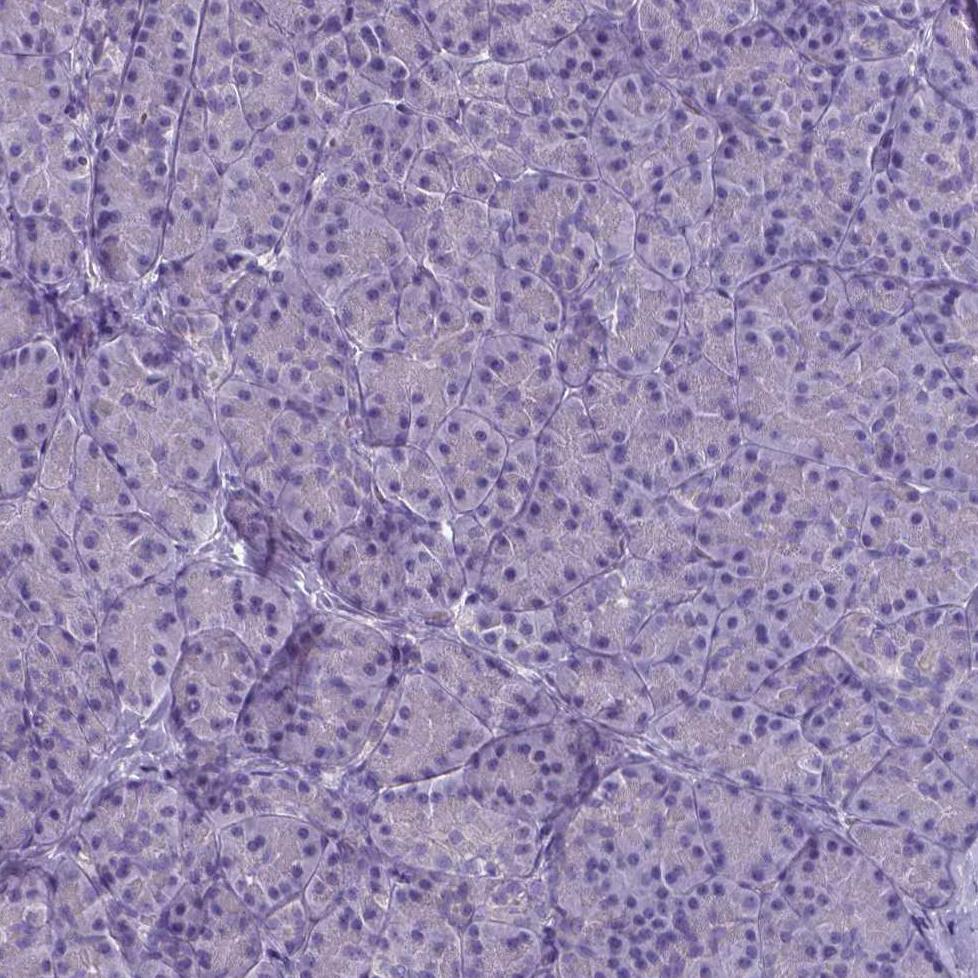 PLA2R1 Antibody (CL0474) Immunohistochemistry: PLA2R1 Antibody (CL0474) [NBP3-52061]