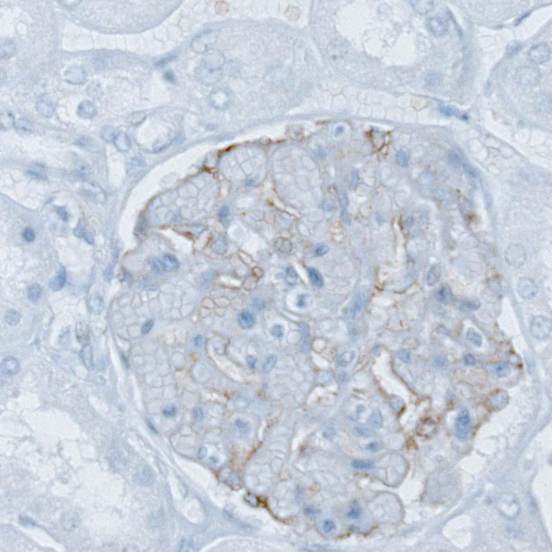 PLA2R1 Antibody (CL0474) Immunohistochemistry: PLA2R1 Antibody (CL0474) [NBP3-52061]