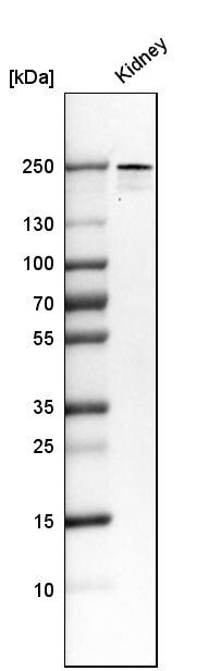 PLA2R1 Antibody (CL0474) Western Blot: PLA2R1 Antibody (CL0474) [NBP3-52061]
