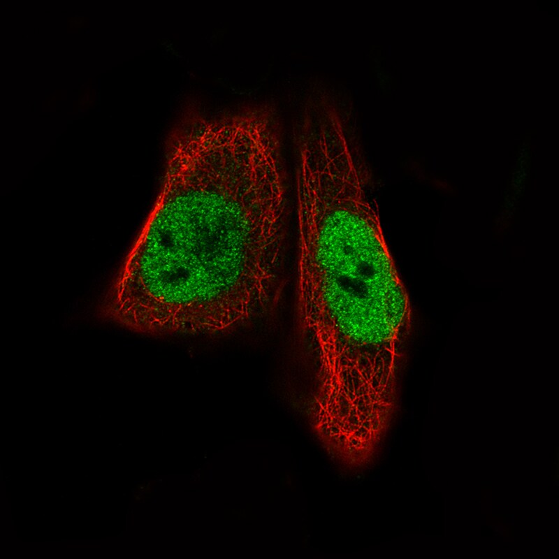 MEF2C Antibody (CL0368) Immunocytochemistry/ Immunofluorescence: MEF2C Antibody (CL0368) [NBP3-52062]