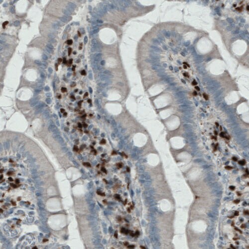MEF2C Antibody (CL0368) Immunohistochemistry: MEF2C Antibody (CL0368) [NBP3-52062]