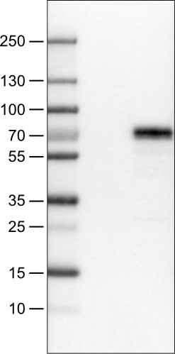 MEF2C Antibody (CL0368) Western Blot: MEF2C Antibody (CL0368) [NBP3-52062]
